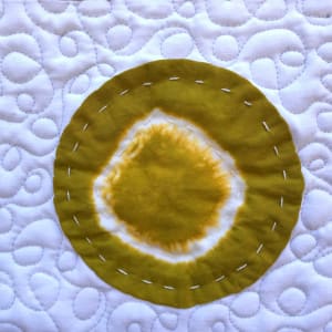 Petri Dishes by Lorraine Woodruff-Long 