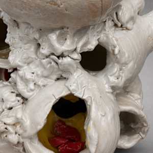 Remains #22 by Lynn Basa, Image 3.