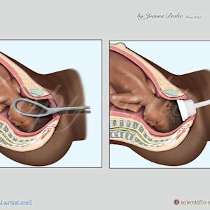 Project a range of anatomy charts for Institute of Pregnancy of Labor and Birth by Joanna Butler, Image 2.