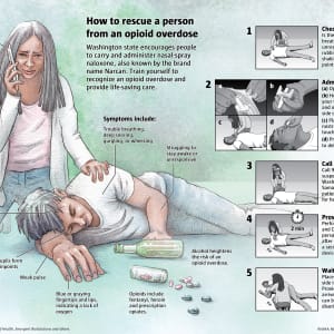 How to rescue a person from an opioid overdose by Fiona Martin