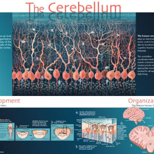 The Cerebellum by Elizabeth Morales