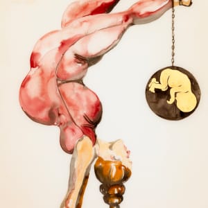 Edema by Alexandra Carter 