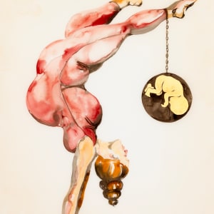 Edema by Alexandra Carter 