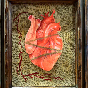 Dysautonomia by Madi Kiernan