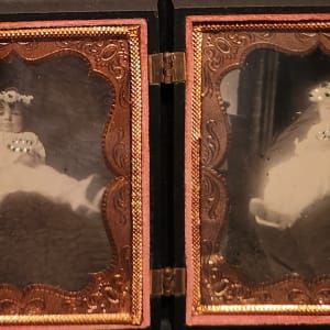 Post mortem of twins or "asleep and awake", circa 1850-1860