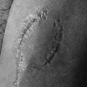 Trademarks (upper arm detail) by Vito Acconci