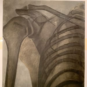 "Clavicle and Ribs" by Edith  Isaac-Rose 